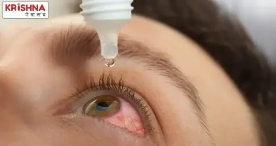 Medicines Eye Drops for Pterygium Treatment in Nanded Waghala Medicines Eye Drops for Pterygium Treatment in Nanded Waghala