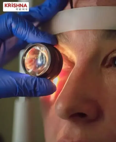 Who is an Ophthalmologist – Dr. Nikhil Govindwar Explains A ophthalmologist checking patients eye power using lens.